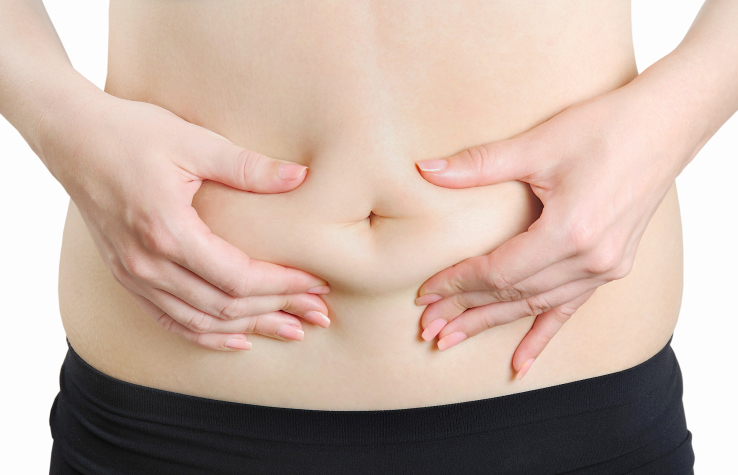 abdominoplastie et obesite