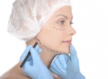 chirurgie esthetique visage