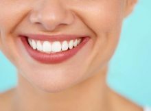 implant dentaire Tunisie
