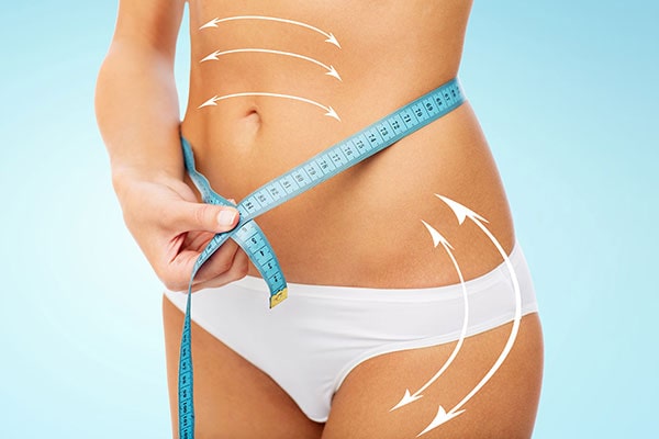 liposuccion