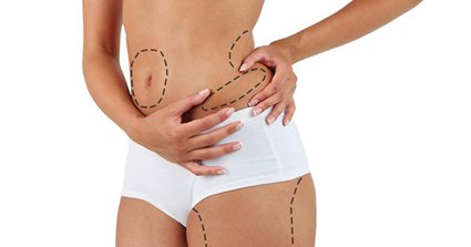 liposuccion en Tunisie